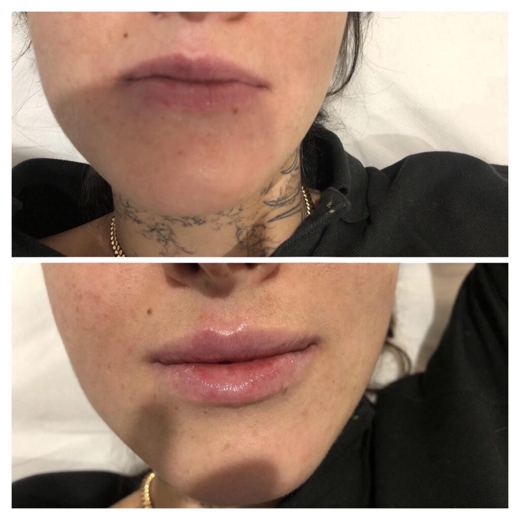 Kobieca twarz z kolczykiem i tatuażem na szyi.