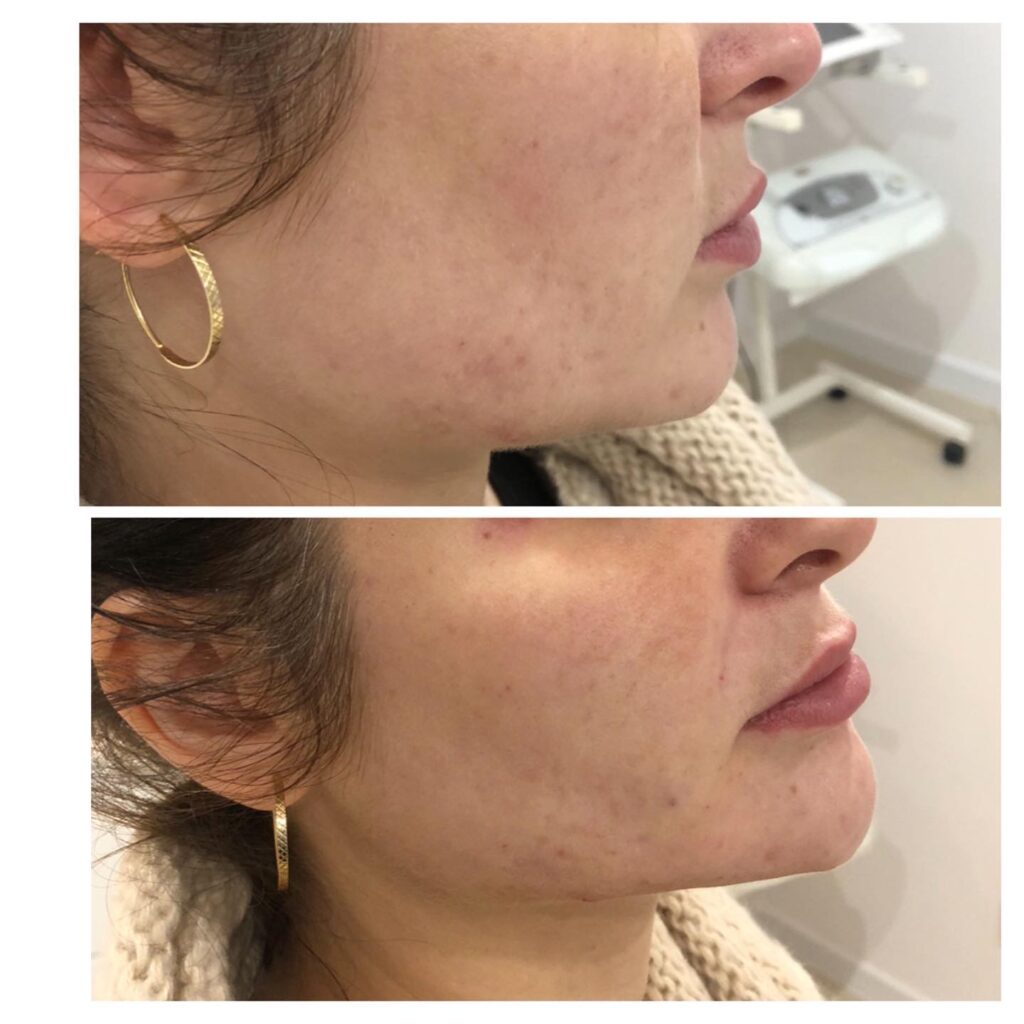 Profil kobiety z kolczykami.