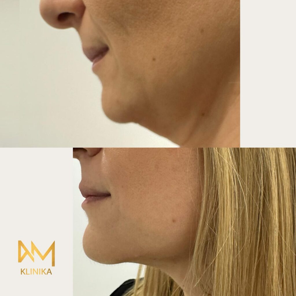 Twarz człowieka z profilu