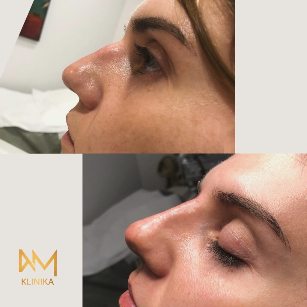 Usta z bliska, oczy zamknięte.